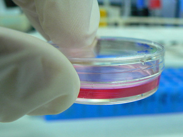 Dùng mô túi màng ối bảo vệ và nuôi giác mạc tổn thương ảnh 1