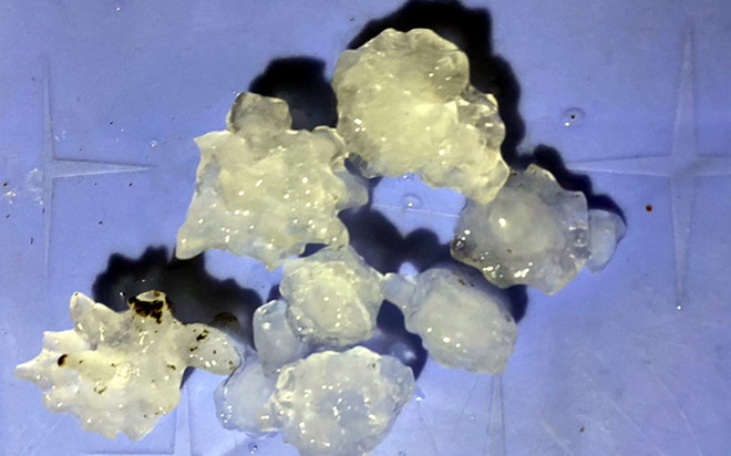 Thành phố Hồ Chí Minh bất ngờ xuất hiện mưa đá trên diện rộng ảnh 1