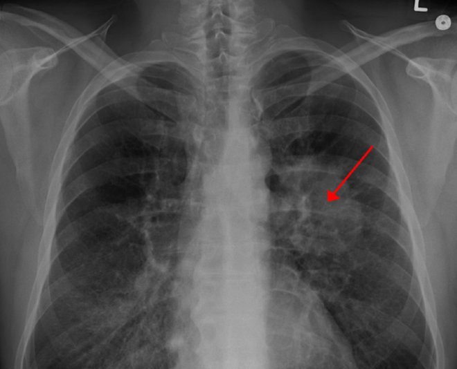 Israel phát triển phương pháp mới chữa trị ung thư ảnh 1