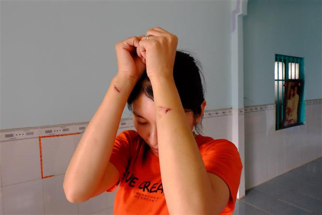 Bình Phước: Xem xét xử lý nghiêm những đối tượng hành hung thai phụ ảnh 1