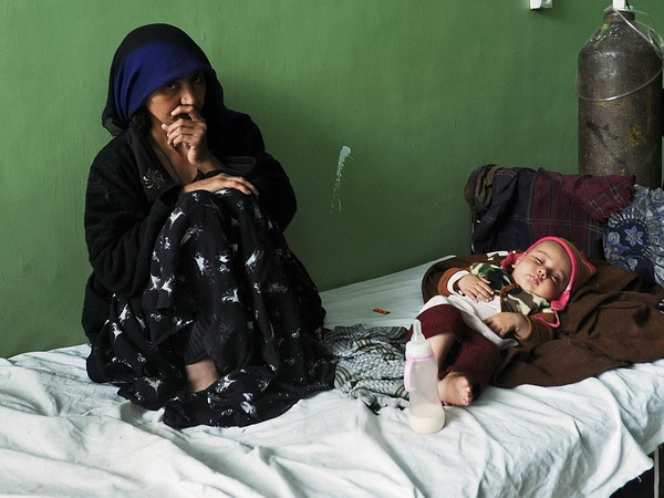 Số trẻ nhiễm lao phổi có thể cao hơn 25% so với LHQ ước tính ảnh 1