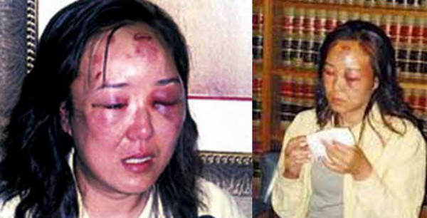 Du khách Trung Quốc nhận bồi thường do bị đánh dã man ở biên giới Mỹ ảnh 1