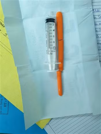 Cứu sống bệnh nhân bị dị vật đâm vào hốc mắt xuyên sọ ảnh 2