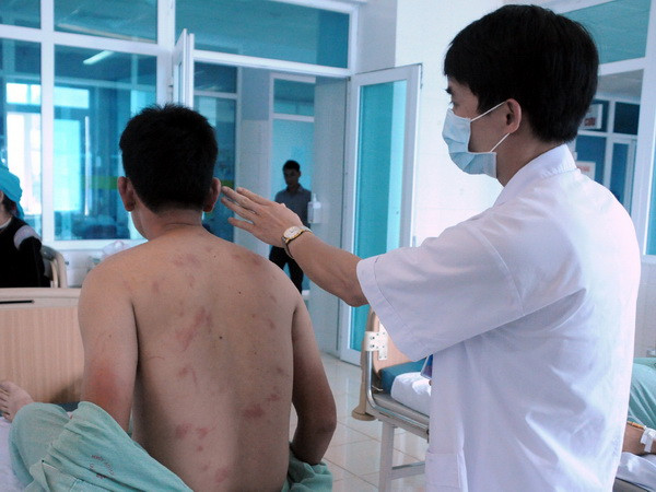 Bị ong rừng bất ngờ tấn công, 15 người phải nhập viện cấp cứu ảnh 1