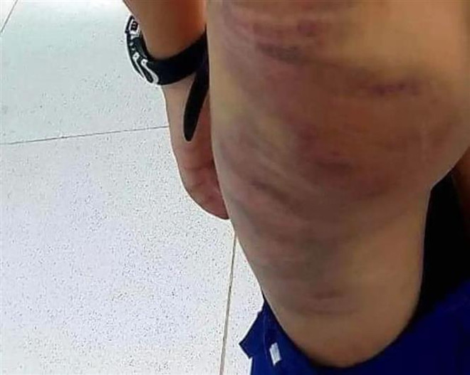 Cà Mau: Khởi tố vụ án mẹ kế hành hạ con riêng của chồng ảnh 1