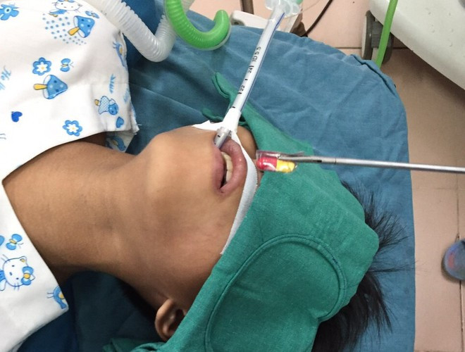 Đồng Nai: Uống thuốc còn cả vỏ, bé trai 10 tuổi nhập viện cấp cứu ảnh 1