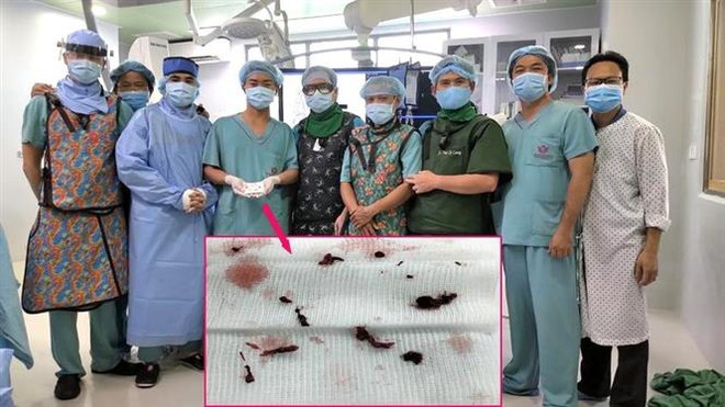 Cảnh báo một số bệnh về não từ việc thường xuyên chóng mặt, đau đầu ảnh 3