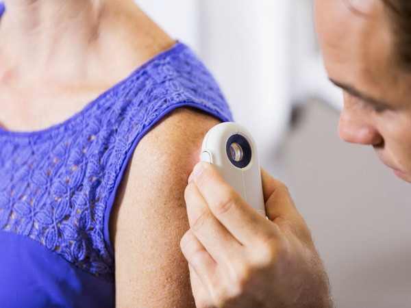 Các nhà khoa học Australia đã ngăn chặn bệnh ung thư da nguy hiểm ảnh 1