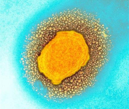 Thêm nhiều ca mắc bệnh đậu mùa khỉ tại Canada và Mỹ ảnh 1