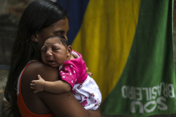 Em bé 1 tháng tuổi mắc chứng đầu nhỏ tại Rio de Janeiro, Brazil. (Nguồn: EPA/TTXVN) Honduras ghị nhận 8 trẻ sơ sinh mắc chứng đầu nhỏ do Zika ảnh 1