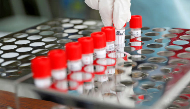 Nhật Bản cho phép lấy mẫu xét nghiệm virus SARS-CoV-2 qua nước bọt ảnh 1