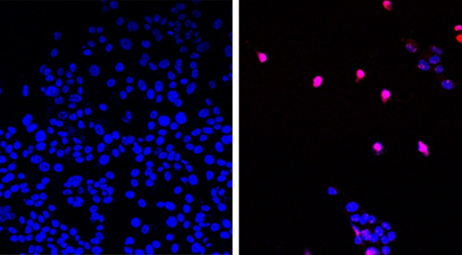 Bắt đầu thử nghiệm thuốc uống trị ung thư đặc biệt trên cơ thể người ảnh 1