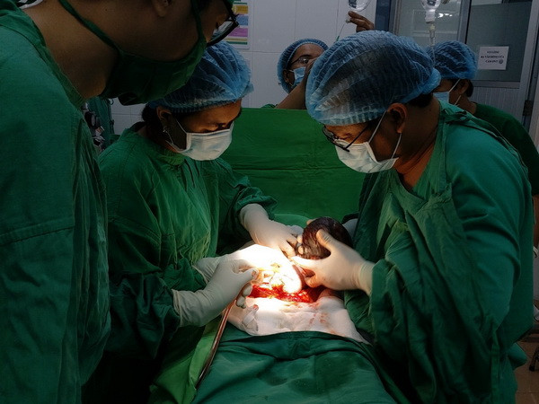 Phẫu thuật thành công cho bệnh nhi 18 giờ tuổi bị tắc ruột ảnh 1