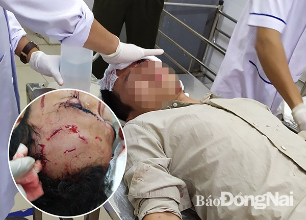 Kiểm lâm Mạc Quý Hùng đang được băng bó vết thương trên đầu. (Ảnh: TTXVN phát) Đồng Nai: Nhóm người kéo đến đánh trọng thương nhân viên kiểm lâm ảnh 1