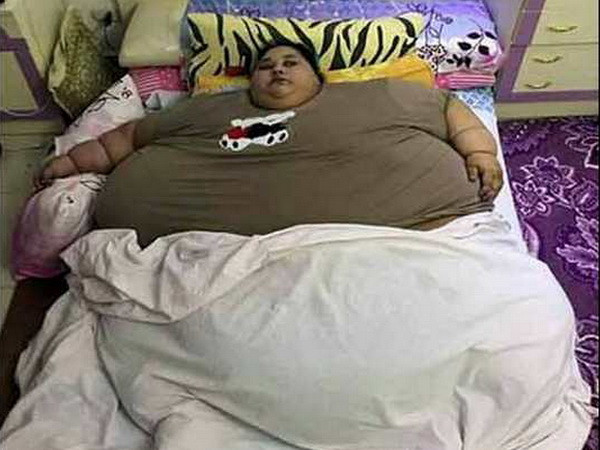 Ấn tượng thành tích giảm cân của người phụ nữ béo nhất thế giới ảnh 1