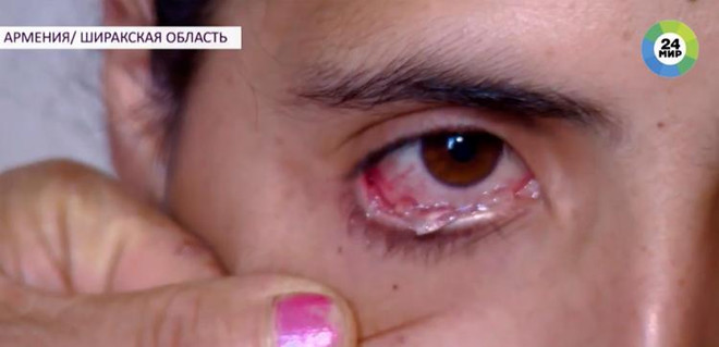 Tranh cãi xung quanh người phụ nữ khóc ra 'nước mắt pha lê' ảnh 1