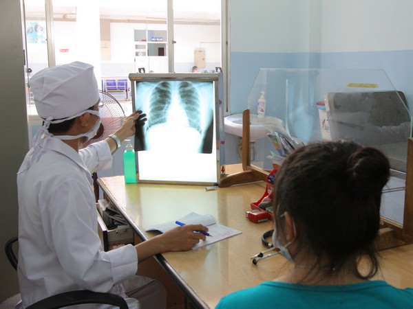 Bước đột phá trong điều trị lao kháng thuốc, tỷ lệ thành công 82% ảnh 1