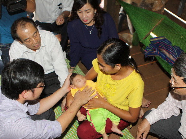 Giám sát trường hợp đầu tiên mắc chứng đầu nhỏ ở Đắk Lắk ảnh 1