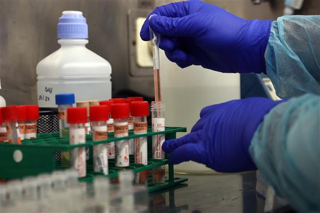 Syria ghi nhận ca nhiễm virus SARS-CoV-2 đầu tiên ảnh 3