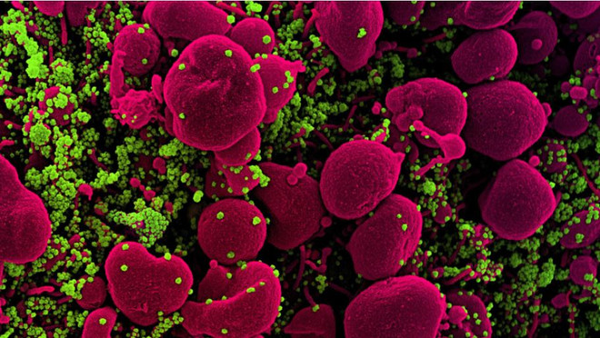 Séc và Thụy Sĩ thử nghiệm kháng thể chống các biến thể của SARS-CoV-2 ảnh 1