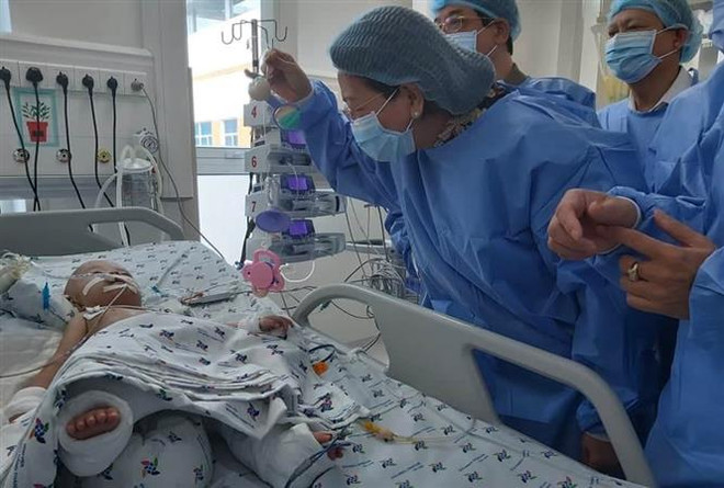 Phó Chủ tịch nước thăm hai bé song sinh Trúc Nhi-Diệu Nhi ảnh 1