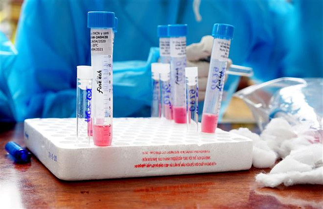 Phú Yên kiến nghị Bộ Y tế hỗ trợ 1.000 test xét nghiệm COVID-19 ảnh 1