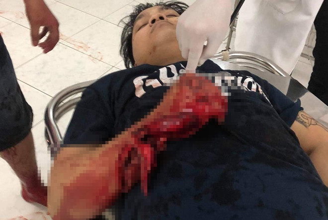 Tiền Giang: Nam thanh niên bị nhóm người bịt mặt chém dã man ảnh 1