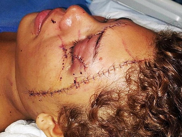 Phẫn nộ cảnh người mẫu bị hành hung ngay trước mặt chồng ảnh 1