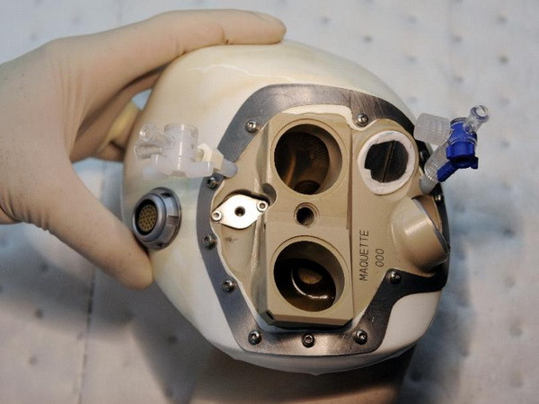 Pháp: Bệnh nhân thứ hai được cấy ghép tim nhân tạo đã qua đời ảnh 1