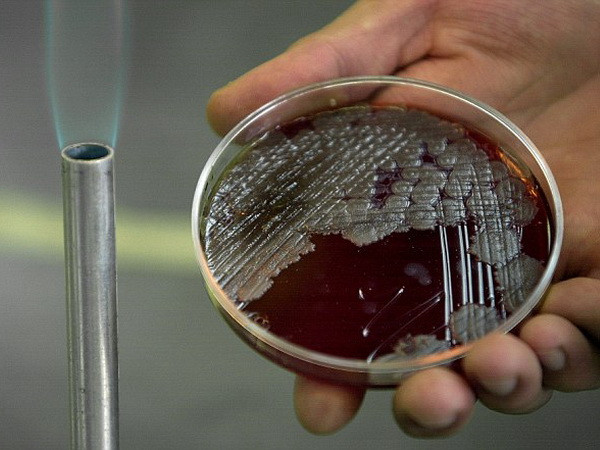 Quân đội Mỹ gửi nhầm mẫu phẩm bệnh than trong nhiều năm qua ảnh 1