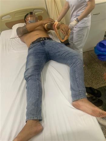 Gia Lai: Công an điều tra vụ nổ súng khiến một người bị thương ảnh 2