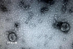 Các nhà nghiên cứu từ Đại học Y khoa Sechenov của Nga cảnh báo những người từng bị nhiễm virus SARS-CoV-2 đều có thể mắc một căn bệnh nguy hiểm: hoại tử xương. (Ảnh: TTXVN phát)