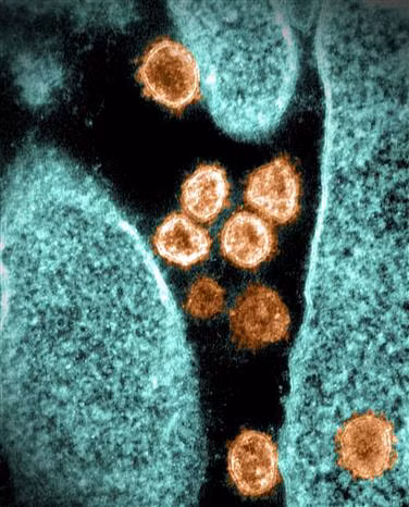 Phát hiện mới về khả năng lây lan của virus SARS-CoV-2 ảnh 2