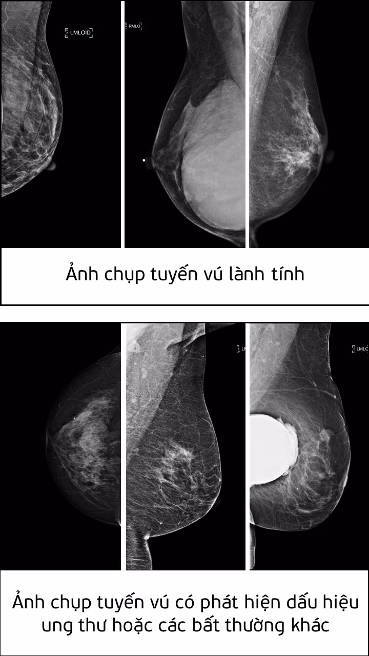 Chuyên gia AI Việt Nam giành Giải Nhất giải pháp phát hiện ung thư ảnh 2