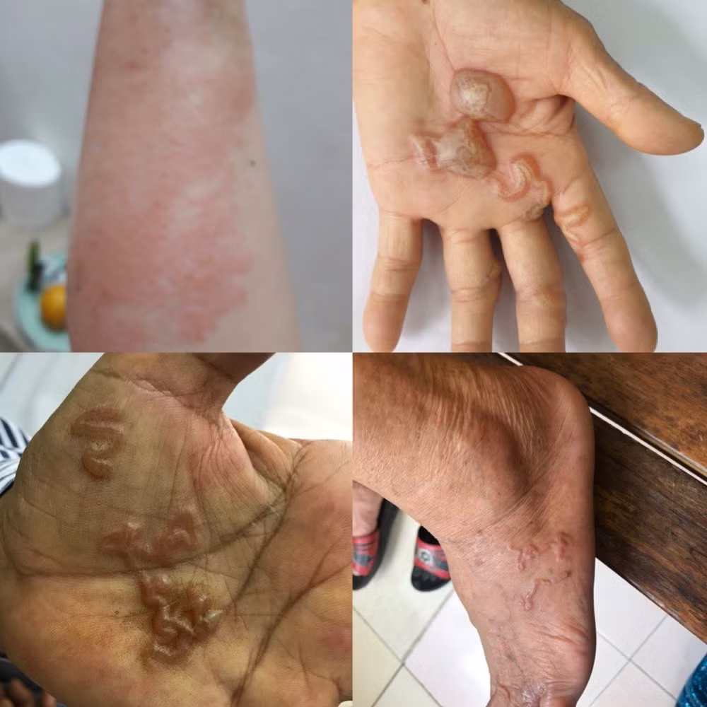 Cảnh báo nhiễm ký sinh trùng từ thú cưng nhưng lầm tưởng là dị ứng ảnh 4