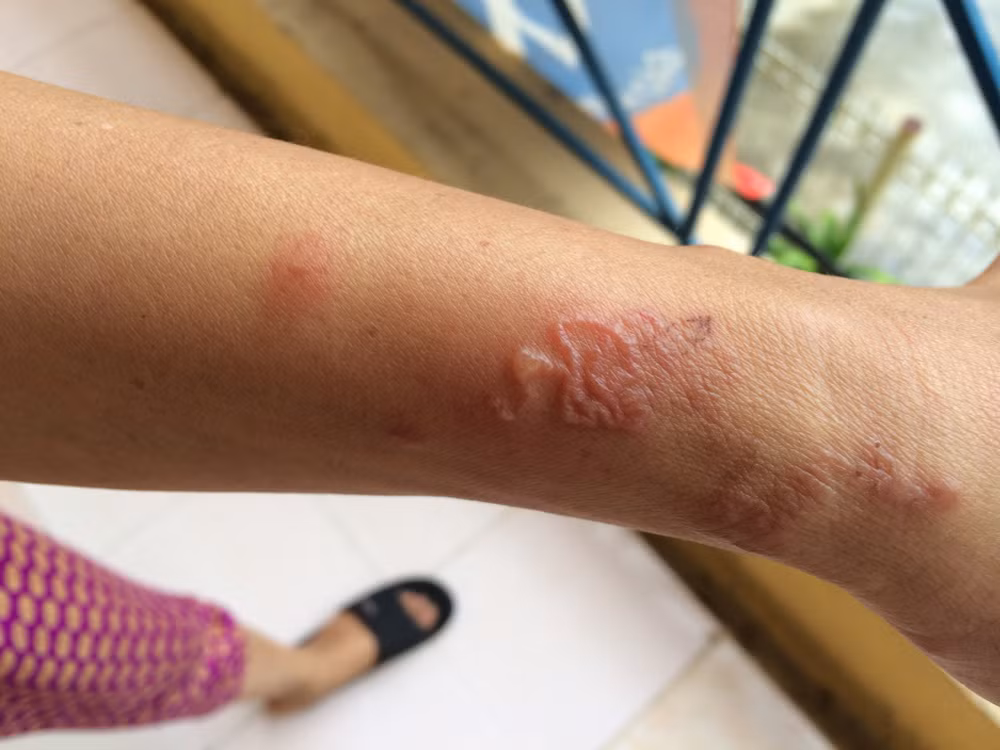 Cảnh báo nhiễm ký sinh trùng từ thú cưng nhưng lầm tưởng là dị ứng ảnh 1