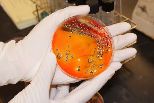 Hàng trăm người nhiễm vi khuẩn salmonella tại Australia ảnh 1