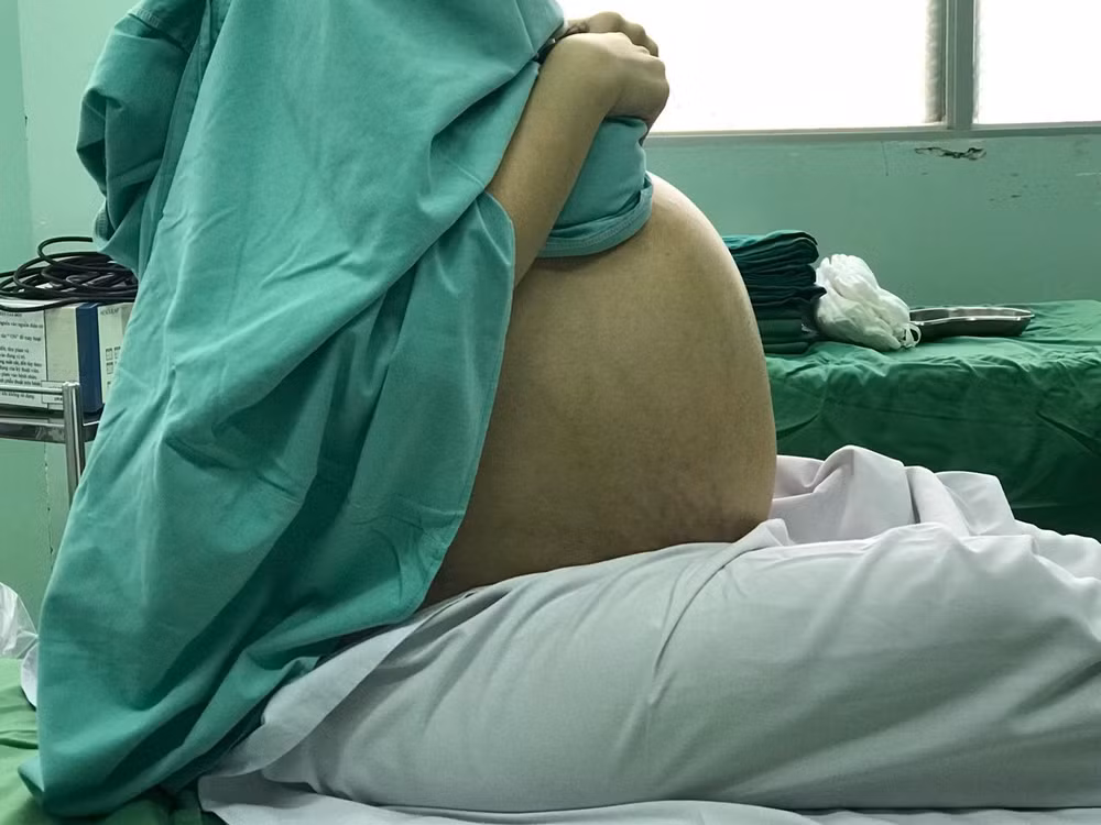 Phẫu thuật khối u buồng trứng nặng 18kg cho một cô gái ảnh 2