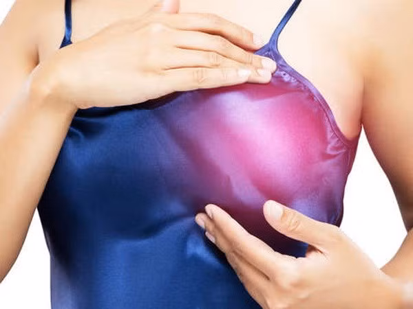 Mỹ phát triển loại thuốc giúp chẩn đoán sớm bệnh ung thư vú ảnh 1