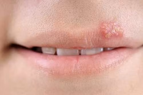 Những món mỹ phẩm tuyệt đối không dùng chung với bất kỳ ai ảnh 2