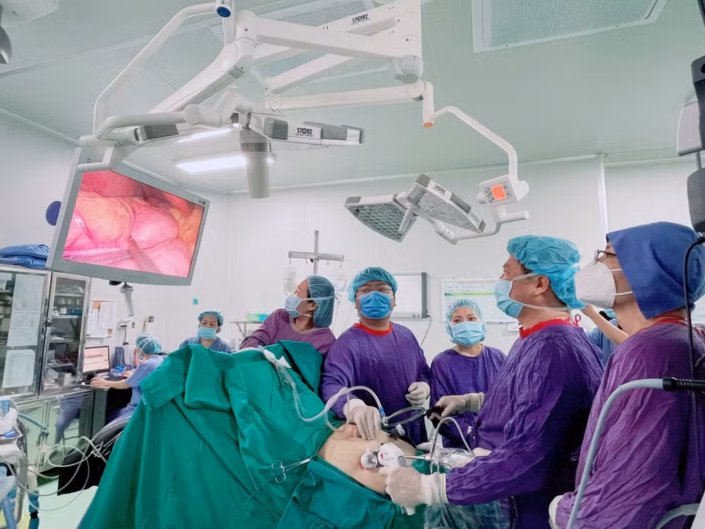 Phương pháp phẫu thuật cắt dạ dày để điều trị cho bệnh nhân béo phì ảnh 3