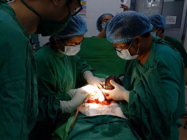 Phẫu thuật thành công cho bệnh nhi 18 giờ tuổi bị tắc ruột ảnh 1