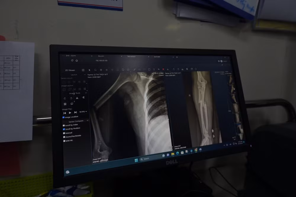 Các bệnh viện nỗ lực hồi phục cho bệnh nhân vụ cháy chung cư mini ảnh 3