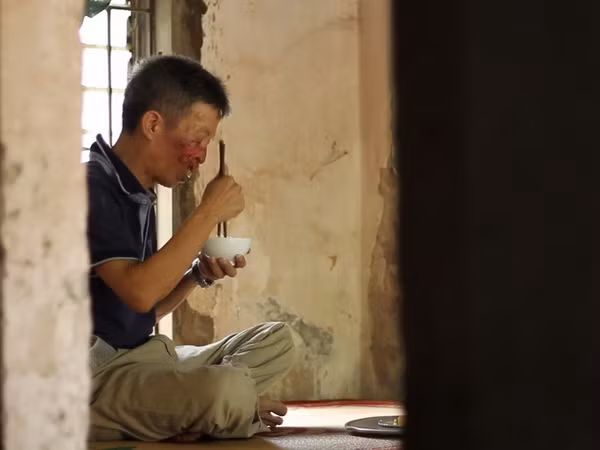 "Phép màu" trả lại gương mặt cho người 10 năm bị ung thư da ảnh 1