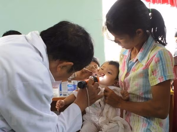 Phẫu thuật nhân đạo miễn phí cho 100 trẻ em khe hở môi, vòm miệng ảnh 1