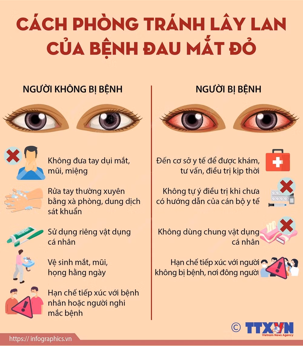 Tây Ninh, Quảng Bình: Phòng, chống bệnh đau mắt đỏ trong trường học ảnh 6
