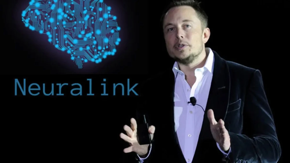Ellon Musk hé lộ thông tin đặc sắc về người đầu tiên được cấy chip não  Neuralink | Vietnam+ (VietnamPlus)