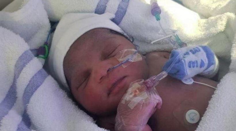 Em bé được cấy ghép máy điều hòa nhịp tim (Nguồn: Bệnh viện Saint-Luc)