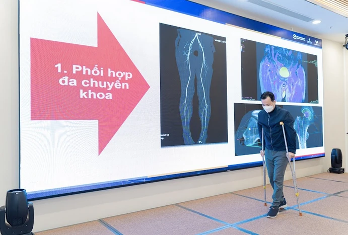 Bệnh nhân Thuận đã có thể tự mình ngồi dậy vững chắc và sau 10 ngày đã có thể một mình tập thành thạo di chuyển bằng nạng. (Ảnh: PV/Vietnam+)