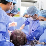 Các bác sỹ Bệnh viện Từ Dũ Thành phố Hồ Chí Minh tiến hành phẫu thuật bóc tách khối u xơ tử cung khổng lồ cho bệnh nhân. (Ảnh: TTXVN phát)